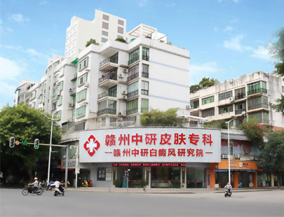 龙南荨麻疹医院